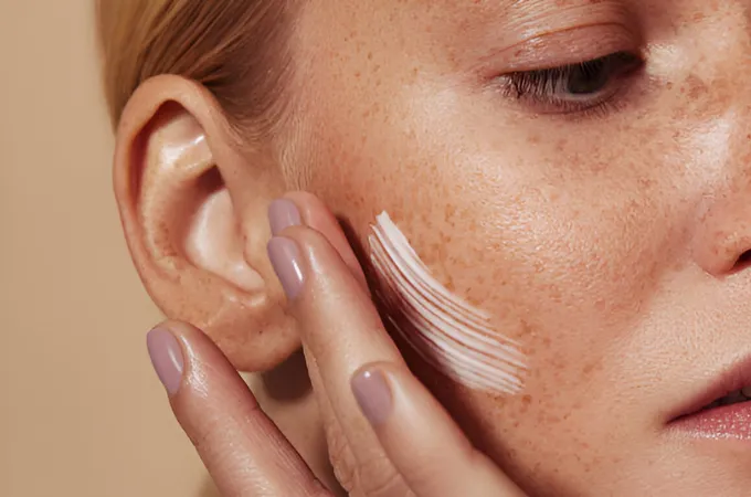 cara menghilangkan freckles