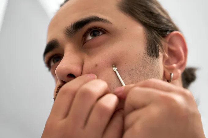 blackhead extraction