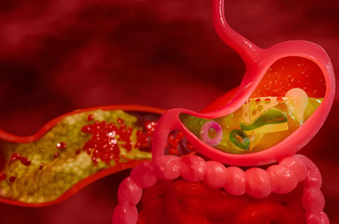 pantangan makanan asam gastritis